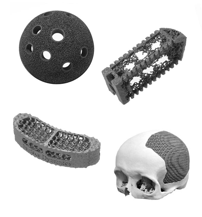 Lincotek Medical - Additive manufacturing examples 02