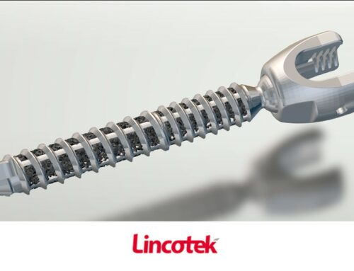 Lincotek secures patent for novel 3D-Printed Orthopedic Screw